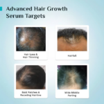 Pilgrim 3% Redensyl, 4% Anagain & 5% Capilia Stem Cell Complex Advanced Hair Growth Serum Roll-On - Image 6