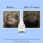 Wishcare Hair Growth Serum Concentrate With 3% Redensyl, 4% Anagain, Rice Water, Biotin - Image 5