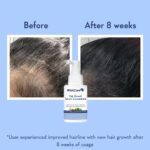 Wishcare Hair Growth Serum Concentrate With 3% Redensyl, 4% Anagain, Rice Water, Biotin - Image 6