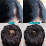 Pilgrim 3% Redensyl, 4% Anagain & 5% Capilia Stem Cell Complex Advanced Hair Growth Serum Roll-On - Image 7